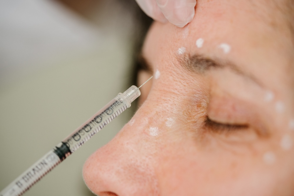 aesthetische-medizin-stuttgart-LEX01632 aesthetische-medizin-stuttgart-LEX01632