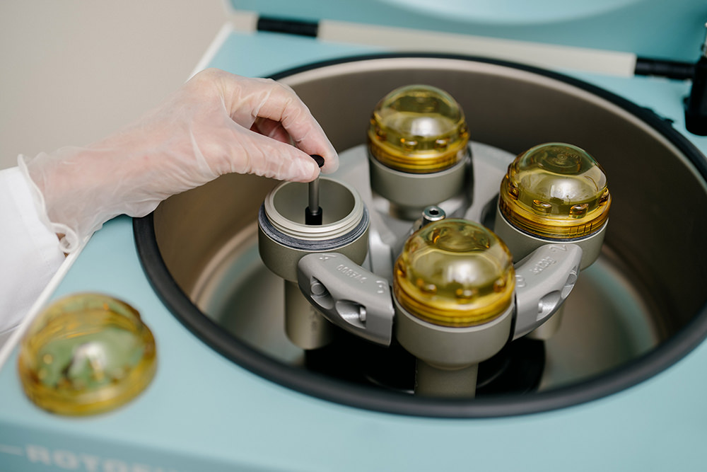 aesthetische-medizin-stuttgart-dr.-nusser-eigenbluttherapie-prp-v5 aesthetische-medizin-stuttgart---dr.-nusser eigenbluttherapie-prp-v5