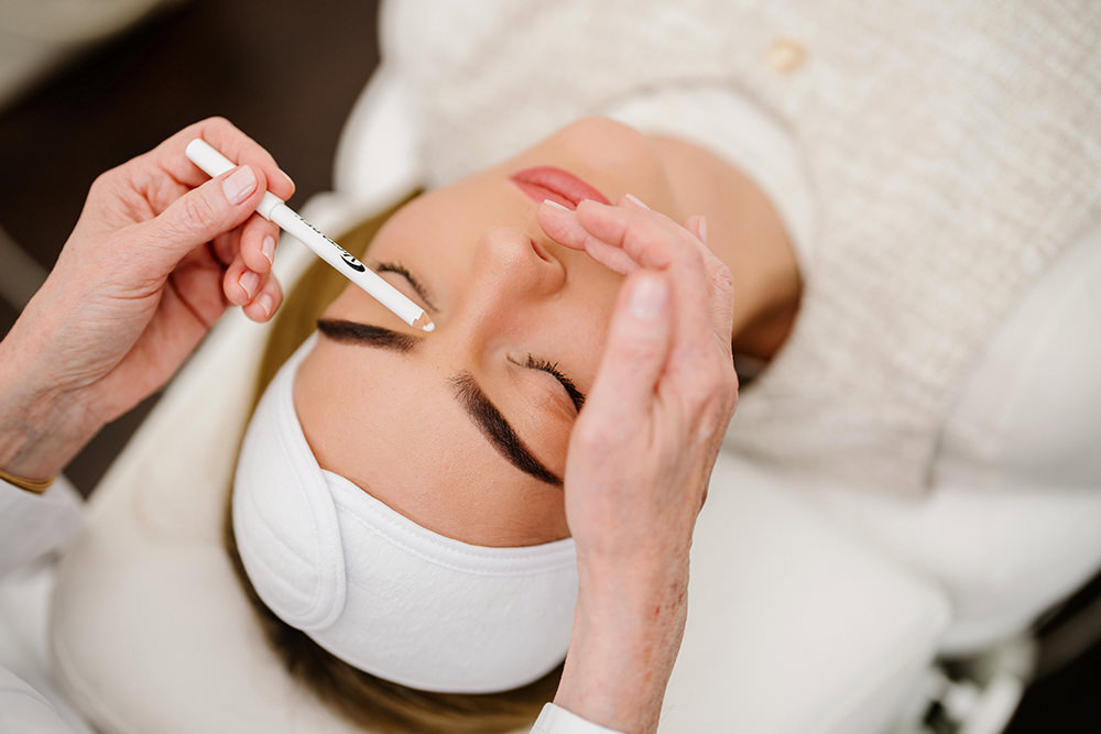 aesthetische-medizin-stuttgart---dr.-nusser faltenunterspritzung-mit-hyaluron-filler-v3